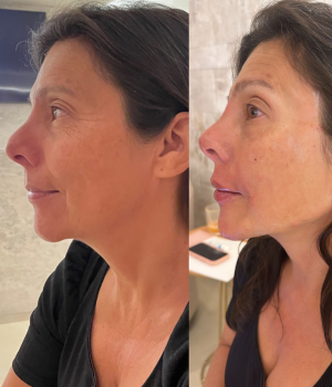 Edna Melo | Harmonização Facial e estética em Águas Claras | Brasília DF