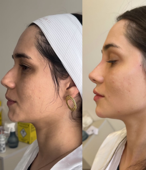 Edna Melo | Harmonização Facial e estética em Águas Claras | Brasília DF