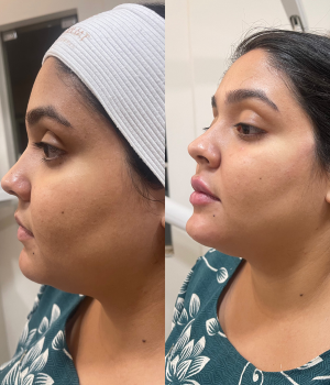 Edna Melo | Harmonização Facial e estética em Águas Claras | Brasília DF