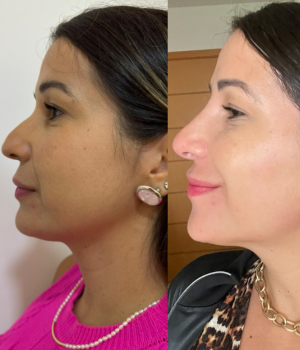 Edna Melo | Harmonização Facial e estética em Águas Claras | Brasília DF